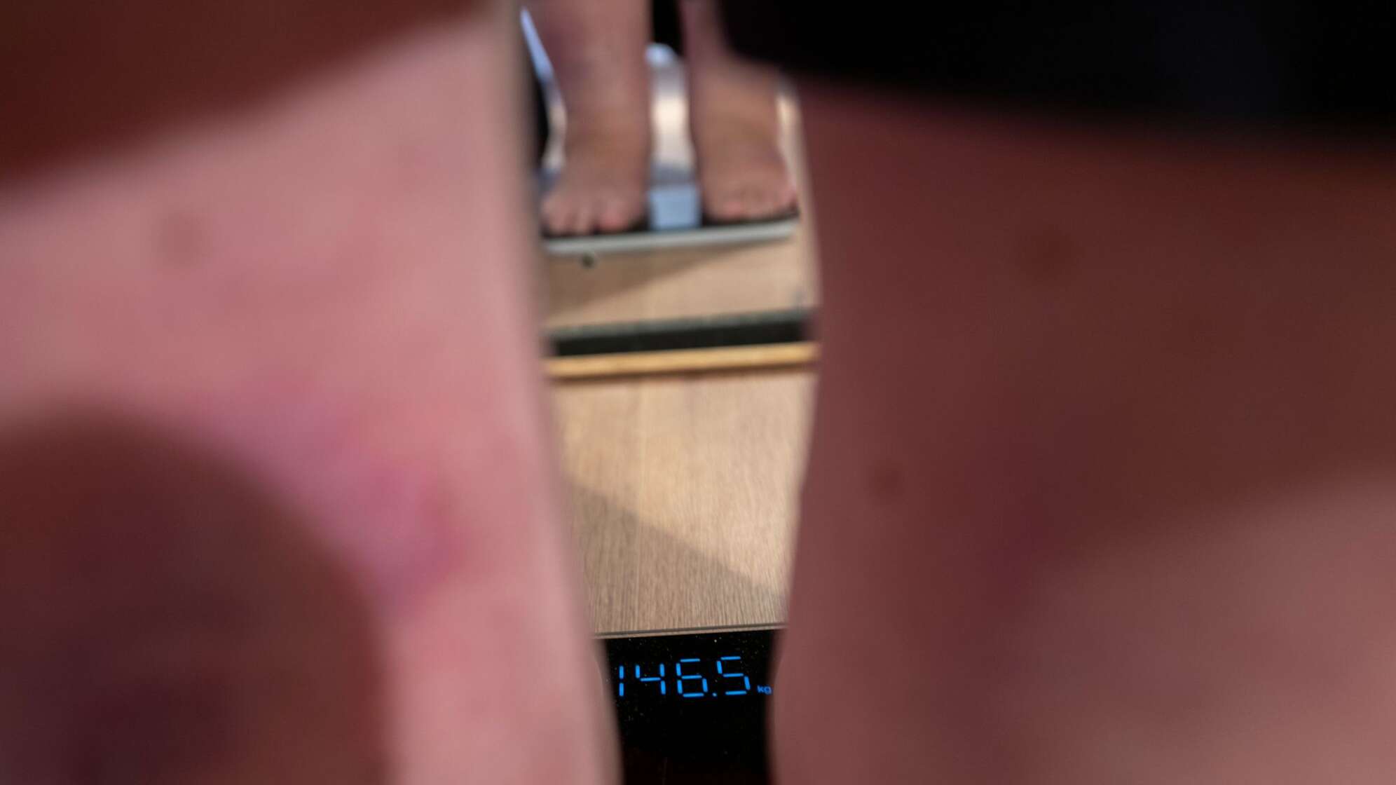 Krankheit Adipositas