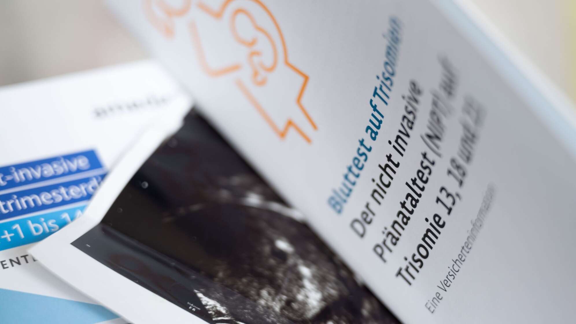 Nichtinvasiver Pränataltests