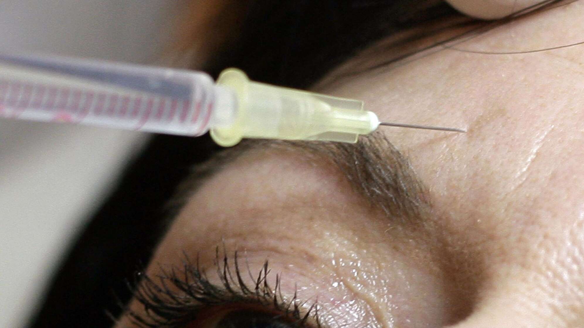 Botox