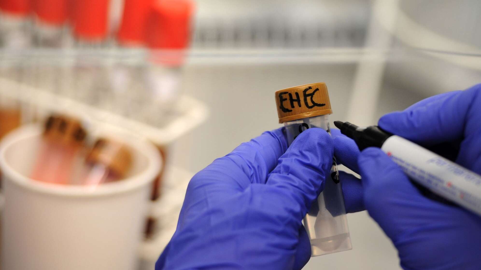 Ehec-Bakterien