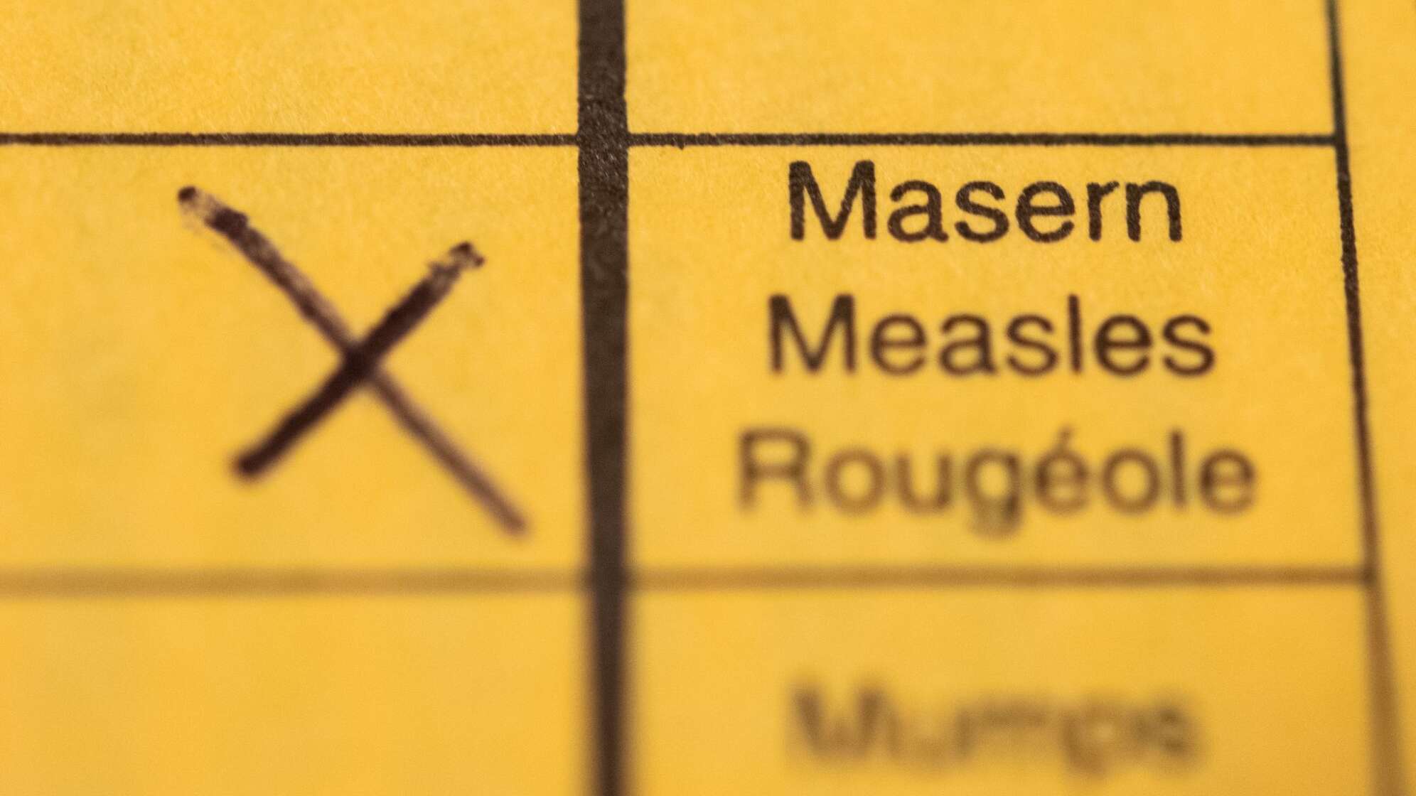 Masernimpfung