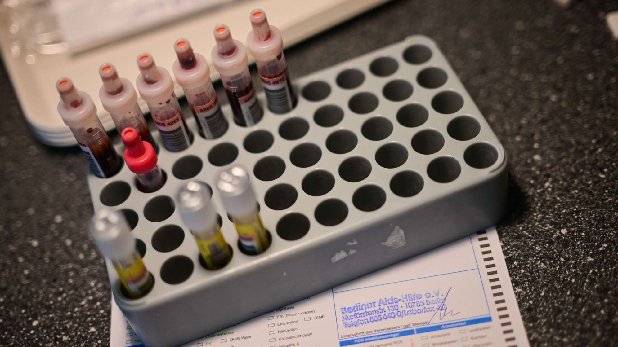 HIV-Test