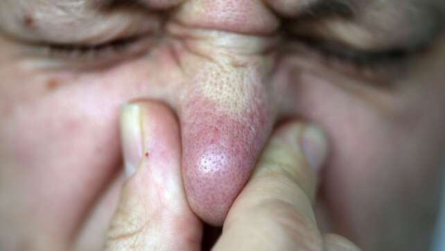 Ursache für Gestank am Untermain gefunden