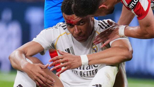Stürmerstar Mbappé nach Kopfwunde im Real-Kader für Bayern