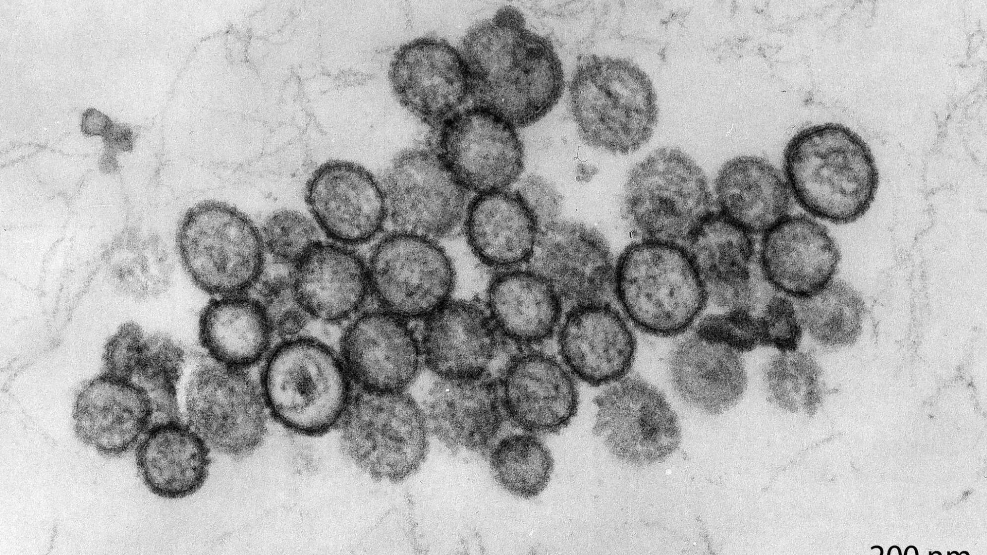 Hantavirus