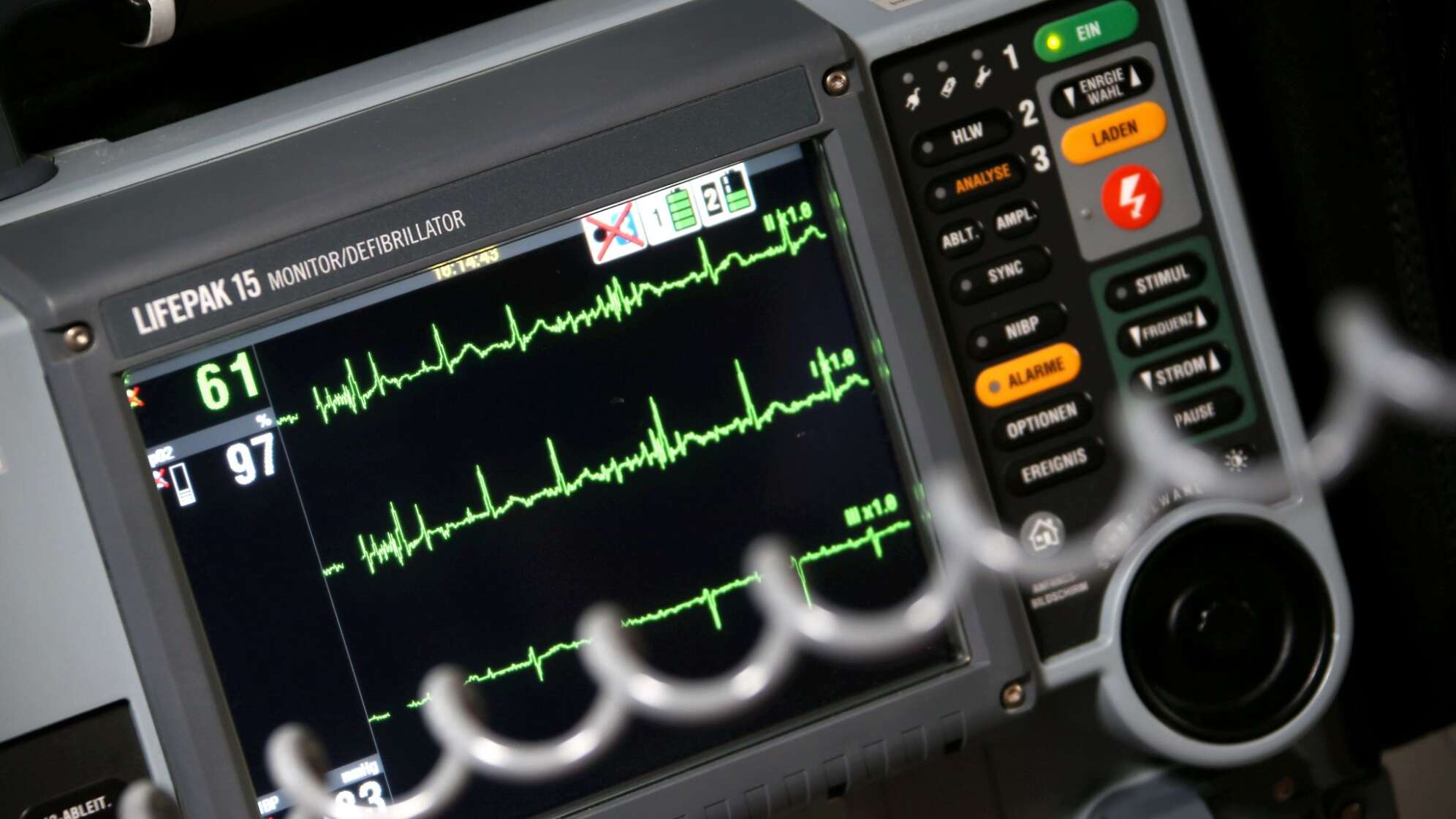 Sinusrhytmus eines Herzens ist auf einem EKG zu sehen