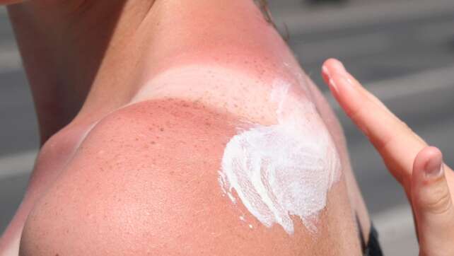 Was man bei Kaiserwetter draußen beachten sollte