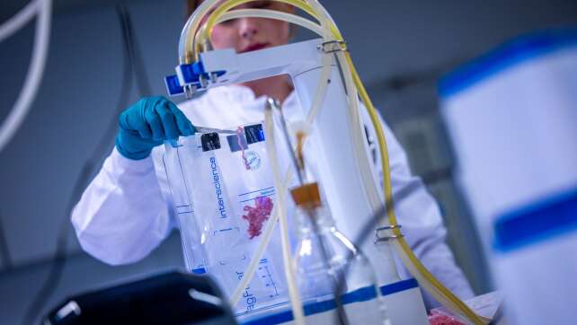 Zu wenig Kontrolleure: Bayerns Lebensmittelcheck lückenhaft?