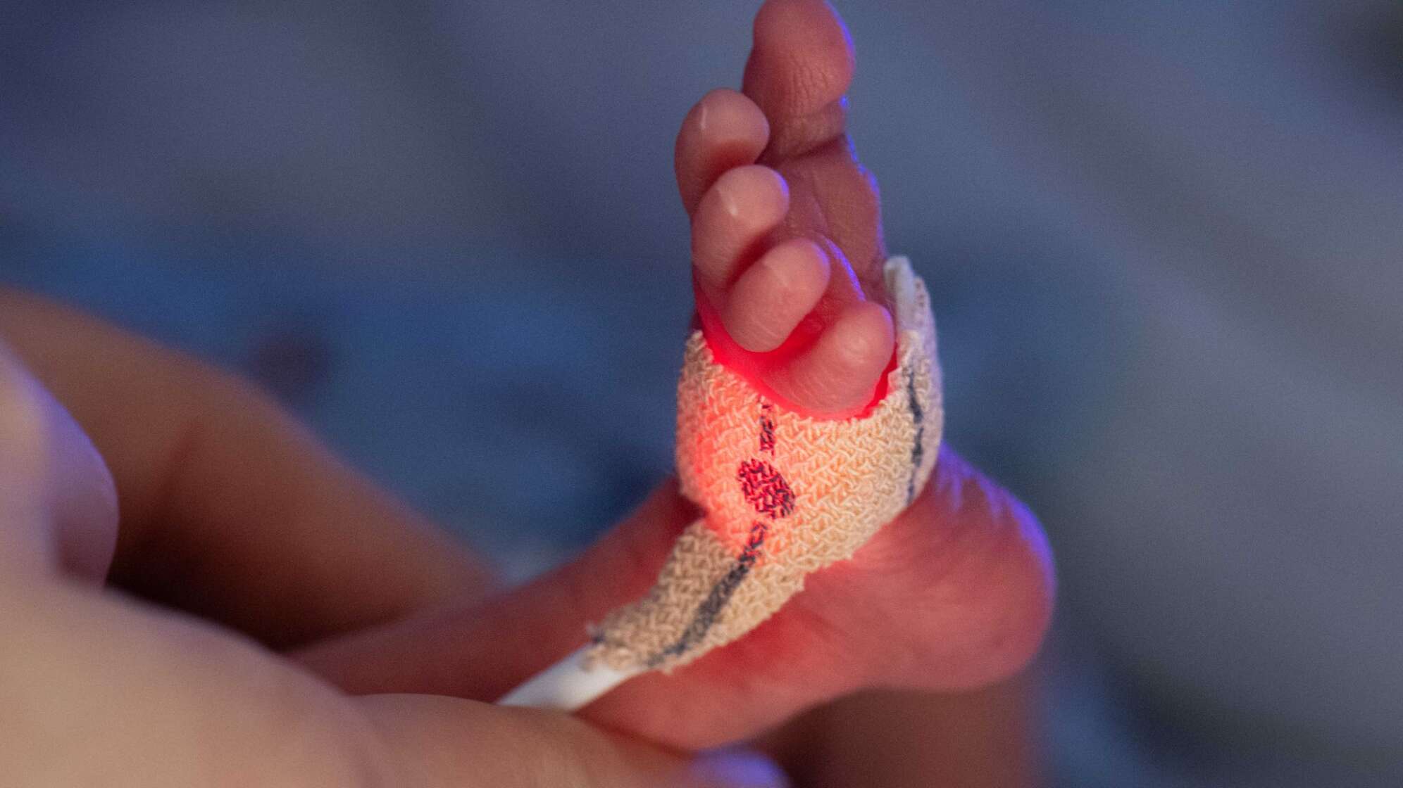 Darmkeim-Infektionen in Kinderklinik: Frühchen gestorben