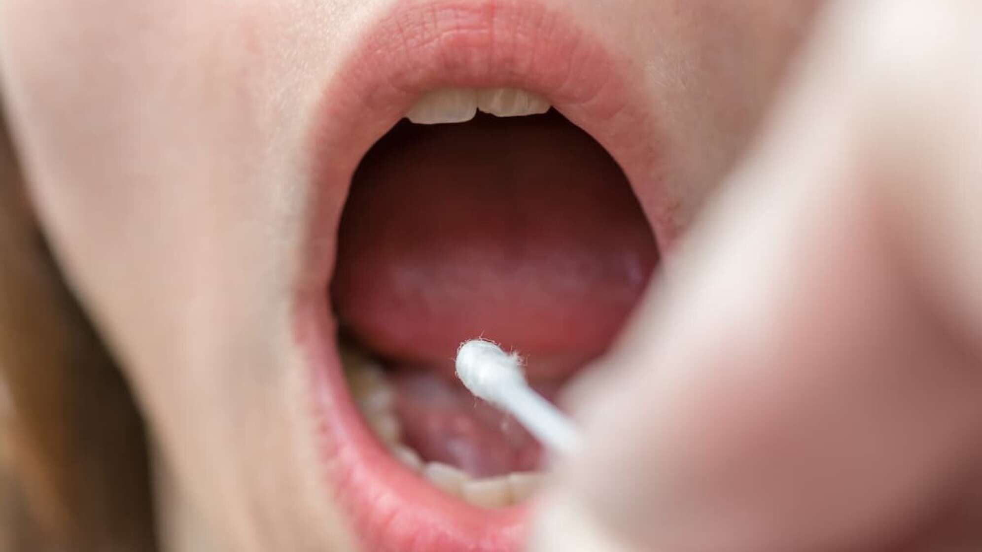 Stammzellenspende