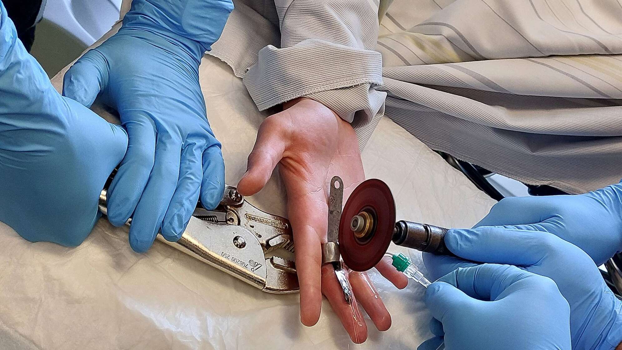 Feuerwehr entfernt Mutter von Finger eines Jugendlichen